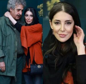 تغییر چهره سحر جعفری‌جوزانی بعد از تزریق/ تصاویر